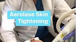 Aerolase YAG Laser Skin Tightening. No down time. For all skin types. Helps skin elasticity. #skincare #skin #laserskinresurfacing #skintreatment #skintightening #aerolase #allabroukmd #newyork | Alla Brouk MD PRP Micrografting Alopecia Hair Loss and ED PShot NY NJ
