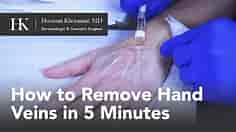 How To Get Rid of Hand Veins in 5 Minutes by Dr. Hooman Khorasani