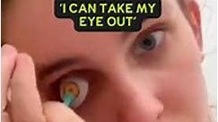 She Has A Prosthetic Eye