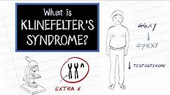 What is Klinefelter's Syndrome?