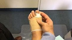 Exercises for Big Toe Following Bunion Surgery