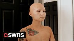 "I have alopecia and had a double mastectomy - I refused reconstruction and tattooed my flat chest"