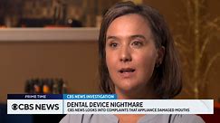 Lawsuit claims dental device damaged patients' teeth