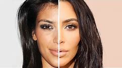 KIM KARDASHIAN: Before and After Plastic Surgery