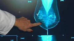 FDA adding breast cancer screening regulations