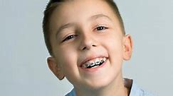 Ultimate Guide to Braces for Kids - Best Dental Care for Kids