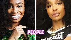 SZA CONFIRMS PLASTIC SURGERY RUMOURS [FROM BGM 13]