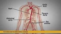 UPMC: Heart Health