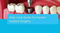 Recovering From Dental Implants Surgery 10 Life Hacks | Tide Dental & Orthodontics