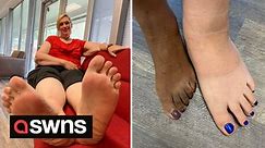 Meet the woman who has largest feet in the world - measuring a whopping size 18