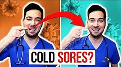 How to get rid of cold sores on lips fast and treatment