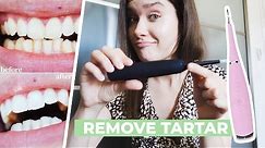 HOW TO REMOVE CALCULUS TARTAR PLAQUE AT HOME | Ultrasonic Tooth Cleaner Review - Does It Work?