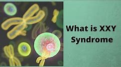 What is XXY Syndrome