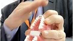Sia Orthodontic Deep overbite corrector... - EDS Orthodontics
