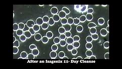 Cleansing for Healthy Blood.flv