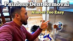 Removing Dent from A Refrigerator Door Using Amazon's Best Selling Kit Its a How To and Review