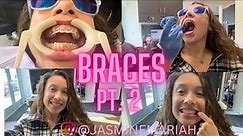 Adult Braces Vlog | Come with me to get braces At 25 Part 2 !!