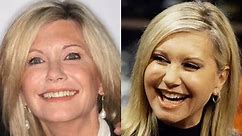 Olivia Newton-John Plastic Surgery Before and After Photos - Latest Plastic Surgery Gossip And News. Plastic Surgery Tips and Advice