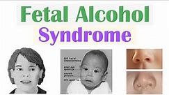 Fetal Alcohol Syndrome (FAS) | Risk Factors, Pathophysiology, Signs & Symptoms, Diagnosis, Treatment