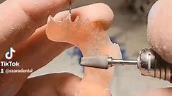 how to make a flipper #ortho #tooth #teeth #fyp #foryou #foryoupage #acrylic @The Bentist / Orthodontist 🦷