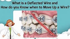Wires Sequence- When to Change Wires. What is Wire Deflection?