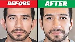 Only 2 mins!! minimize large ears without surgery & tool, protruding ears,