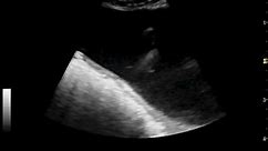 ureteral jet entering dog's bladder on ultrasonography