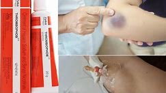 Thrombophob ointment | Treatment of Thrombosis | Superficial Blood Clotting | medicine information