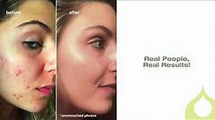 The Game-Changing & Award Winning Blemish Clearing Product!