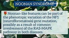 Noonan Syndrome Features, Cause, Genetics, Karyotype and Diagnosis