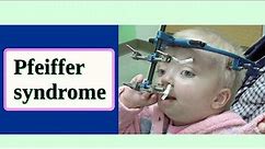 Pfeiffer syndrome
