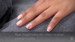 Mayo Clinic Minute: Fingernails are clues to your health
