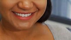 Five tips to whiter teeth, naturally