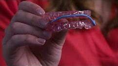 SomnoDent® Avant™: Our Most Comfortable Oral Appliance EVER!