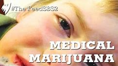 Medical Marijuana For Childhood Epilepsy