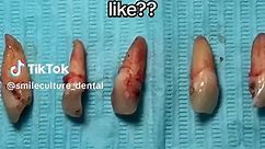 The more you know🦷 #dental #teeth #dentist | teeth