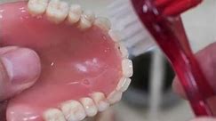 Tips for Cleaning Dentures | Lifecare Dental Clinic