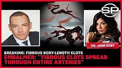 BREAKING: Fibrous Body-Length Clots Embalmer: “Fibrous Clots Spread Through Entire Arteries” | SGT Report