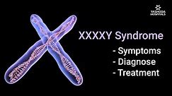 49XXXXY Syndrome Symptoms, Diagnosis, and Treatment | Health Tips | Yashoda Hospitals