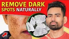 How to Remove Dark Spots and Get Clear Skin? (Pigmentation, Dark Underarms, Acne scars & more)