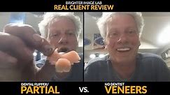 Dental Partial / Flipper vs. No Dentist Veneers- MUST WATCH- Brighter Image Lab Real Client Review