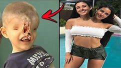 10 Most Bizarre & Unusual People Who Shock The World