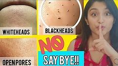 BLACKHEADS/WHITEHEADS/OPEN PORES HOME REMEDY | Deep Cleansing Routine 5 Steps100% works