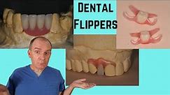 What is a dental flipper?