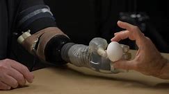 Prosthetic tech advances give sense of touch
