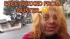 Duster Burxed Face..🤨#viral #fyp #fypage #newvideo #damn #coolisllusions #realtalkbois #huffingduster#gonewrong