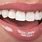Beautiful Veneers Teeth