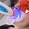 Dental Office Teeth Whitening
