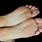 Dry Scaly Skin On Feet