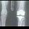 Funny Knee X-ray